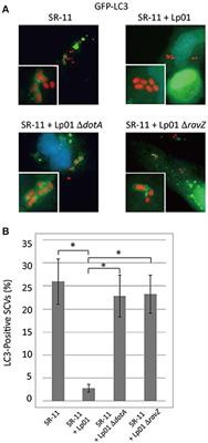 Legionella RavZ Plays a Role in Preventing Ubiquitin Recruitment to Bacteria-Containing Vacuoles